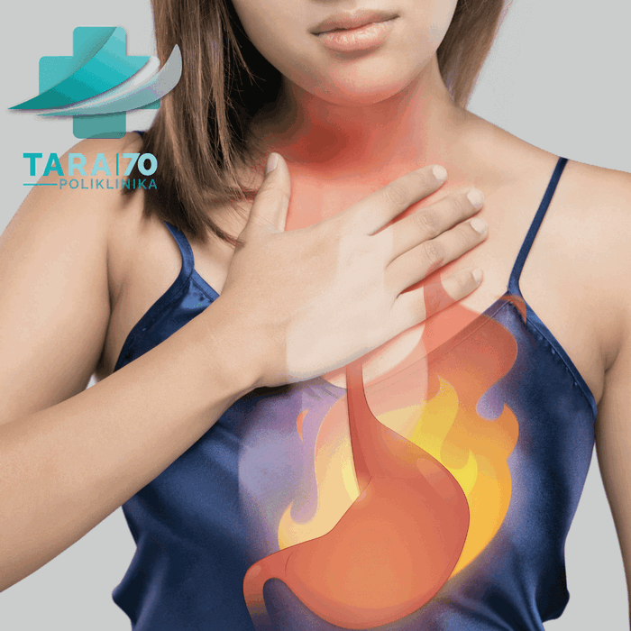 Gastroezofagealna refluksna bolest (GERB): Uzroci, simptomi i tretmani